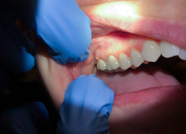 Best Emergency Treatment for Jaw Pain or Injury in Atco, NJ